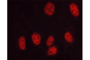 ABIN6267569 staining HUVEC cells treated with serum 20% 30' by ICC/IF. (PRKDC antibody  (pThr2647))