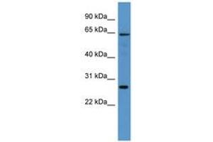 Image no. 1 for anti-Flavin Containing Monooxygenase 4 (FMO4) (AA 161-210) antibody (ABIN6746255)