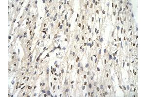 Rabbit Anti-GTF2E2 Antibody       Paraffin Embedded Tissue:  Human cardiac cell   Cellular Data:  Epithelial cells of renal tubule  Antibody Concentration:   4. (GTF2E2 antibody  (N-Term))