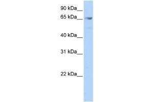 WB Suggested Anti-MEF2A Antibody Titration:  0. (MEF2A antibody  (Middle Region))