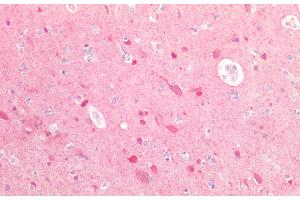 Detection of UBQLN2 in Human Brain Tissue using Polyclonal Antibody to Ubiquilin 2 (UBQLN2) (Ubiquilin 2 antibody  (AA 33-126))