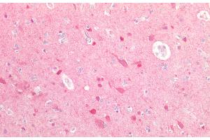 Detection of UBQLN2 in Human Brain Tissue using Polyclonal Antibody to Ubiquilin 2 (UBQLN2) (Ubiquilin 2 antibody  (AA 33-126))