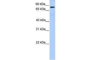 C12ORF40 antibody used at 1 ug/ml to detect target protein. (C12orf40 antibody  (N-Term))
