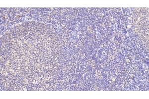 Detection of TFR in Porcine Lymph node Tissue using Polyclonal Antibody to Transferrin Receptor (TFR) (Transferrin Receptor antibody  (AA 578-765))