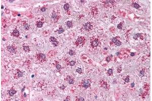 Human Liver (formalin-fixed, paraffin-embedded) stained with CAT antibody ABIN214024 at 5 ug/ml followed by biotinylated goat anti-rabbit IgG secondary antibody ABIN481713, alkaline phosphatase-streptavidin and chromogen. (Catalase antibody)