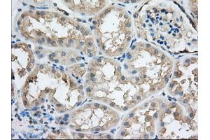 Immunohistochemical staining of paraffin-embedded Human prostate tissue using anti-SNX9 mouse monoclonal antibody.
