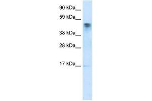 FLJ13798 antibody used at 2. (FLJ13798 (FLJ13798) (C-Term) antibody)