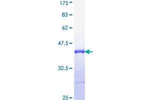 Image no. 1 for Interferon Regulatory Factor 5 (IRF5) (AA 395-504) protein (GST tag) (ABIN1308092) (IRF5 Protein (AA 395-504) (GST tag))