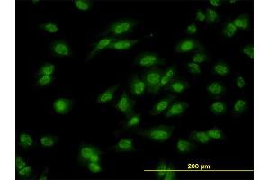 Immunofluorescence (IF) image for anti-Distal-Less Homeobox Protein 1 (DLX1) (AA 152-255) antibody (ABIN560612)
