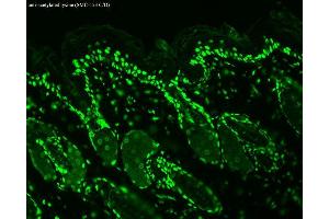 Immunohistochemistry analysis using Mouse Anti-Acetylated Lysine Monoclonal Antibody, Clone 7F8 . (Lysine (lys) (acetylated) antibody (Biotin))