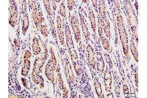 Formalin-fixed and paraffin-embedded human stomach tissue labeled with Rabbit Anti-OPN Polyclonal Antibody, Unconjugated (ABIN723695) at 1:200 followed by conjugation to the secondary antibody and DAB staining (Osteopontin antibody  (AA 141-220))