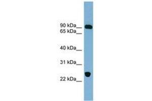 Image no. 1 for anti-Vacuolar Protein Sorting 53 Homolog (VPS53) (AA 431-480) antibody (ABIN6742156) (VPS53 antibody  (AA 431-480))