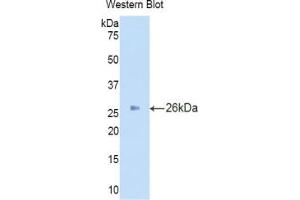 Western blot analysis of the recombinant protein. (IDS antibody  (AA 95-289))