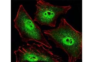 Fluorescent image of A549 cells stained with SIRT1 antibody. (SIRT1 antibody  (AA 566-601))