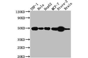 Western Blot Positive WB detected in: THP-1 whole cell lysate, Hela whole cell lysate, HepG2 whole cell lysate, MCF-7 whole cell lysate, Ntera-2 whole cell lysate, Mouse Brain whole cell lysate All lanes: TACR1 antibody at 1:1000 Secondary Goat polyclonal to rabbit IgG at 1/50000 dilution Predicted band size: 47, 36 kDa Observed band size: 50 kDa (Recombinant TACR1 antibody)