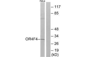 Western blot analysis of extracts from HeLa cells, using OR4F4 antibody. (OR4F4 antibody  (C-Term))