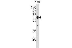 RNF180 Antibody (C-term) western blot analysis in Y79 cell line lysates (35µg/lane). (RNF180 antibody  (C-Term))