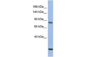WB Suggested Anti-MAP3K11  Antibody Titration: 0. (MAP3K11 antibody  (Middle Region))