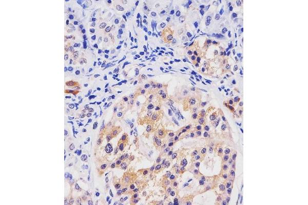 HHLA2 antibody  (AA 58-87)