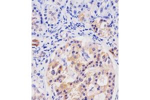 A staining HHLA2 in human pancreas tissue sections by Immunohistochemistry (IHC-P - paraformaldehyde-fixed, paraffin-embedded sections). (HHLA2 antibody  (AA 58-87))