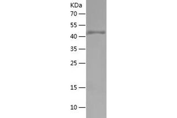Occludin Protein (OCLN) (AA 270-441) (His-IF2DI Tag)