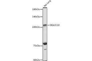 Western blot analysis of extracts of Rat lung, using SIGLEC10 antibody (ABIN7270292) at 1:1000 dilution.