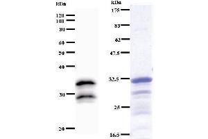 Left: VAX2 staining. (VAX2 antibody)