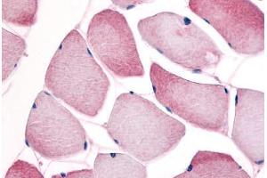 Human Skeletal Muscle (formalin-fixed, paraffin-embedded) stained with CCNL1 antibody ABIN214640 at 10 ug/ml followed by biotinylated goat anti-rabbit IgG secondary antibody ABIN481713, alkaline phosphatase-streptavidin and chromogen. (Cyclin L1 antibody)
