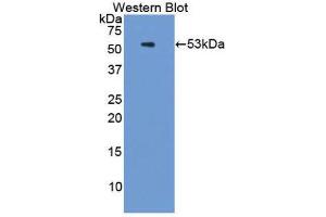Western Blotting (WB) image for anti-Proteasome (Prosome, Macropain) 26S Subunit, ATPase, 3 (PSMC3) (AA 2-439) antibody (ABIN1860336) (PSMC3 antibody  (AA 2-439))