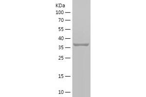 Western Blotting (WB) image for Stomatin (EPB72)-Like 2 (STOML2) (AA 253-356) protein (His-IF2DI Tag) (ABIN7282748) (STOML2 Protein (AA 253-356) (His-IF2DI Tag))