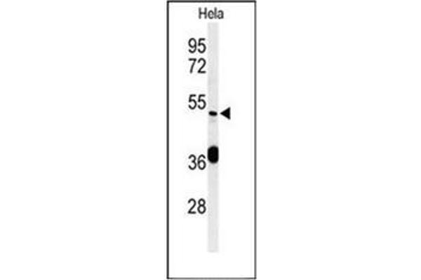DDX49 antibody  (C-Term)
