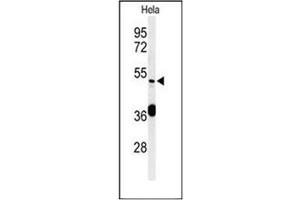 Western blot analysis of DDX49 Antibody (C-term) in Hela cell line lysates (35ug/lane).