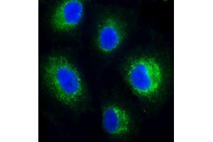 Immunofluorescent analysis of 4 % paraformaldehyde-fixed, 0. (FADS2 antibody)