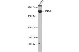 Western blot analysis of extracts of MCF-7 cells using SETD5 Polyclonal Antibody at dilution of 1:300. (SETD5 antibody)