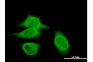 Immunofluorescence of purified MaxPab antibody to CAST on HeLa cell. (Calpastatin antibody  (AA 1-667))