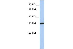 WB Suggested Anti-FBXO16 Antibody Titration: 0. (FBXO16 antibody  (N-Term))