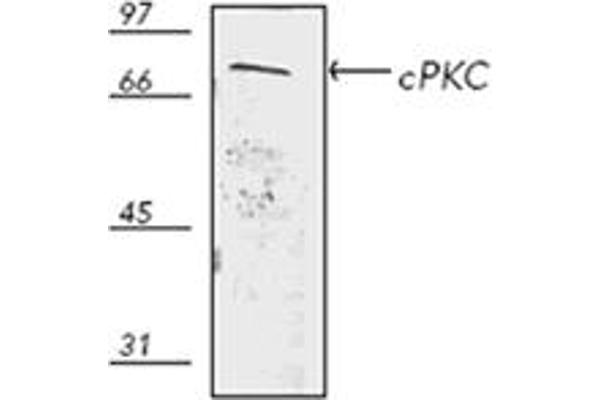 PKC Antikörper