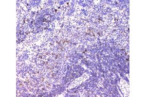 IHC analysis of IGLL1 using anti-IGLL1 antibody (ABIN6719329).