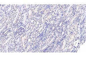 Detection of WWP2 in Human Kidney Tissue using Polyclonal Antibody to WW Domain Containing E3 Ubiquitin Protein Ligase 2 (WWP2) (WWP2 antibody  (AA 601-870))