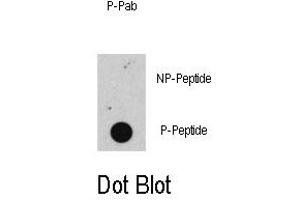 Image no. 1 for anti-Retinoblastoma 1 (RB1) (pSer608) antibody (ABIN358211) (Retinoblastoma 1 antibody  (pSer608))