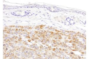 Immunohistochemistry (IHC) image for anti-Isocitrate Dehydrogenase 2 (NADP+), Mitochondrial (IDH2) (AA 402-452) antibody (ABIN7455220) (IDH2 antibody  (AA 402-452))