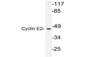 Western blot (WB) analysis of Cyclin E2 antibody in extracts from Jurkat cell. (Cyclin E2 antibody)