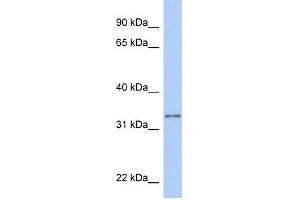 GSTO2 antibody used at 1 ug/ml to detect target protein. (GSTO2 antibody  (N-Term))