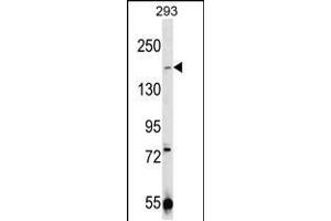 CHAK1 Antibody  (ABIN392614 and ABIN2837991) western blot analysis in 293 cell line lysates (35 μg/lane). (TRPM7 antibody  (C-Term))