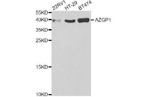 Western blot analysis of extracts of various cell lines, using AZGP1 antibody (ABIN5973101) at 1/1000 dilution. (AZGP1 antibody)
