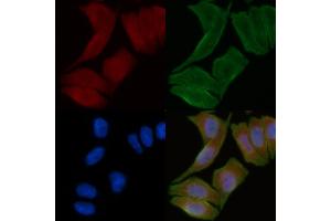 ABIN6258528 and ABIN6274789 staining Hela cells(30 min of UV treatment) by IF/ICC. (ABHD14A antibody  (Internal Region))