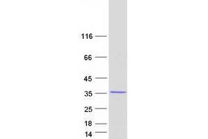 Proteasome Subunit alpha 4 (PSMA4) (Transcript Variant 2) protein (Myc-DYKDDDDK Tag)
