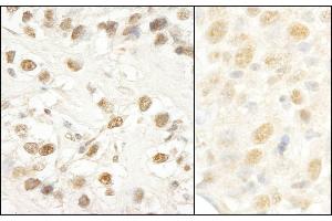 anti-LUC7-Like 3 (LUC7L3) (AA 1-50) antibody