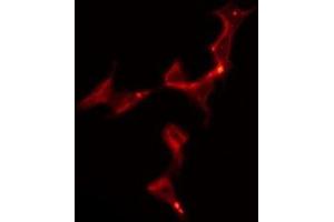 ABIN6275907 staining Hela by IF/ICC. (5HT1B Receptor antibody  (Internal Region))
