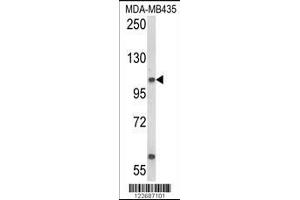 Western blot analysis of CASD1 Antibody in MDA-MB435 cell line lysates (35ug/lane) (CASD1 antibody  (N-Term))